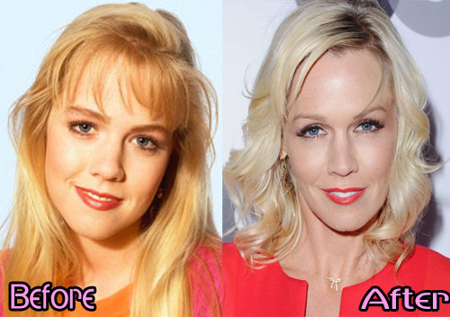 jennie-garth-nose-job-before-and-after